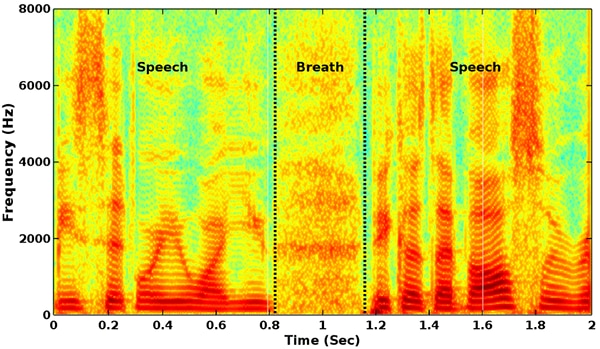 Spectrogram of human speech